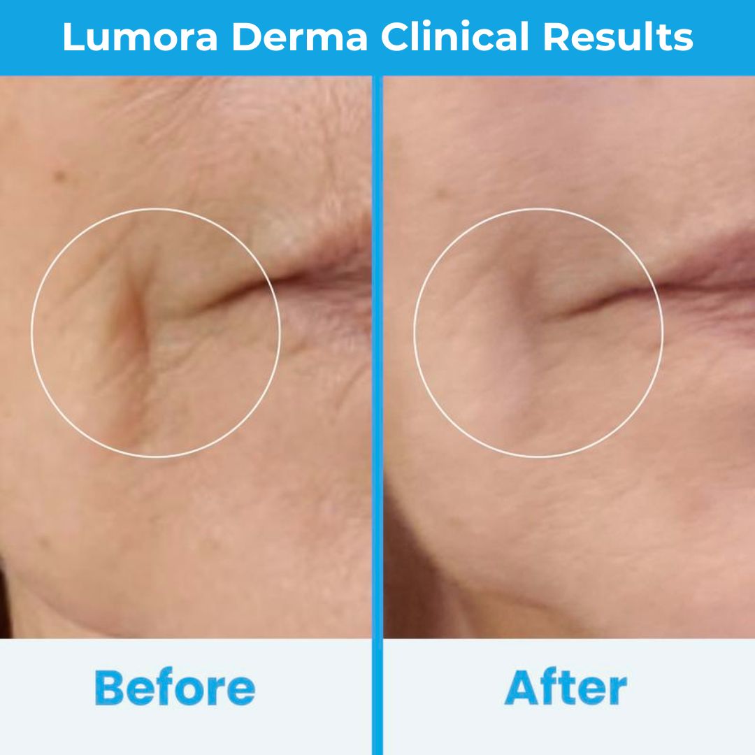 Lumora High Frequency Wand