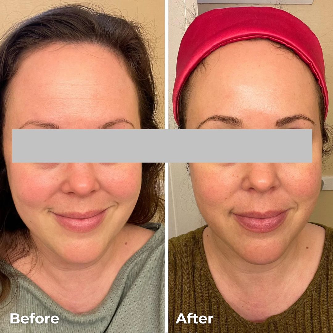 Lumora Silk Peptide EGF Toner